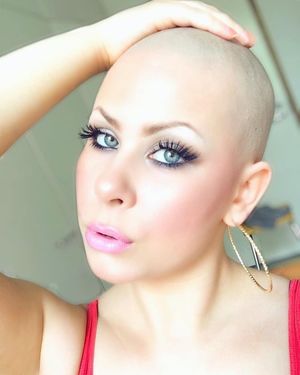 Instagram Analytics Bald Women..