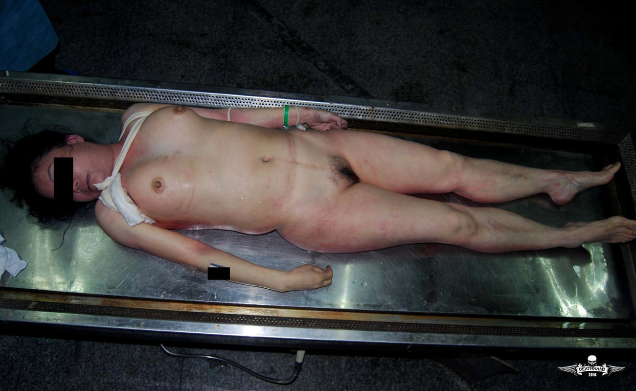 Naked Girls Postmortem.